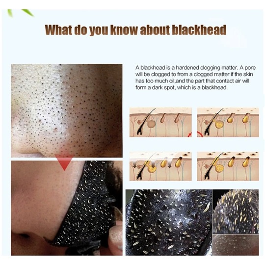 Deep Cleansing Blackhead Removal Charcoal Black Mask